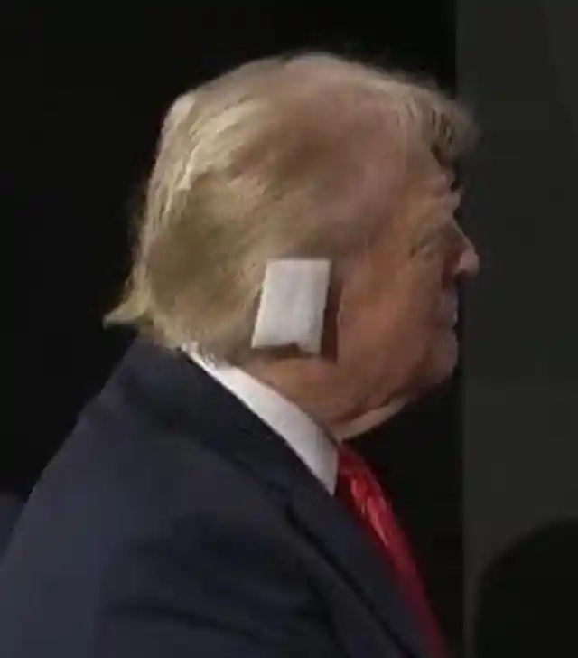 [COMMENTARY/WATCH]: What Actually Happened to Donald Trump's Ear?