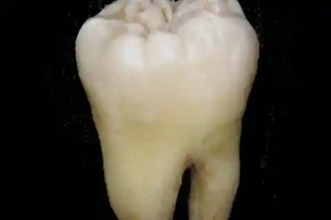 The Tooth